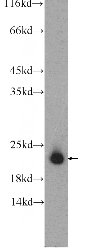 human testis tissue were subjected to SDS PAGE followed by western blot with Catalog No:115540(SPANXB1 Antibody) at dilution of 1:300