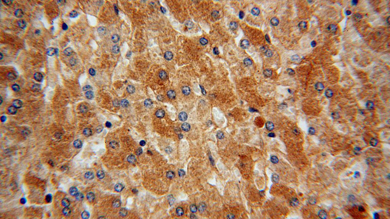 Immunohistochemical of paraffin-embedded human liver using Catalog No:110623(AHSG antibody) at dilution of 1:200 (under 40x lens)