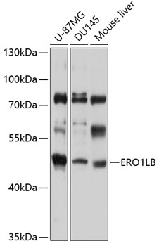 Western blot - ERO1LB Polyclonal Antibody 