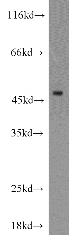 RAW264.7 cells were subjected to SDS PAGE followed by western blot with Catalog No:113014(NADK antibody) at dilution of 1:1000