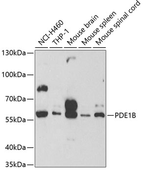 Western blot - PDE1B Polyclonal Antibody 