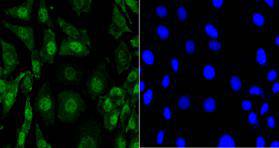 Fig2: Immunocytochemical staining of SH-SY-5Y cells using anti-EFTUD2 Mouse mAb