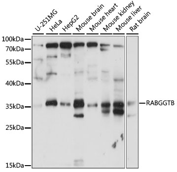 Western blot - RABGGTB Polyclonal Antibody 