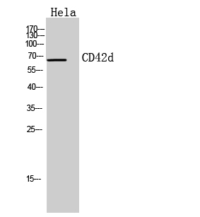 Fig1:; Western Blot analysis of Hela cells using CD42d Polyclonal Antibody.. Secondary antibody（catalog#：HA1001) was diluted at 1:20000