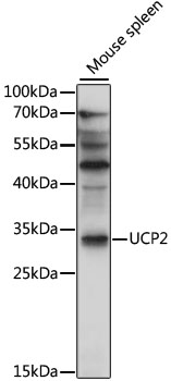 Western blot - UCP2 Polyclonal Antibody 