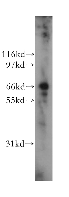 MCF7 cells were subjected to SDS PAGE followed by western blot with Catalog No:116307(TRIM25 antibody) at dilution of 1:500