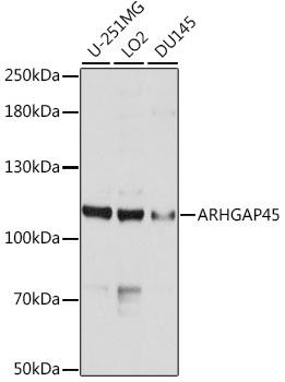 Western blot - ARHGAP45 Polyclonal Antibody 
