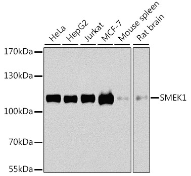 Western blot - SMEK1 Polyclonal Antibody 