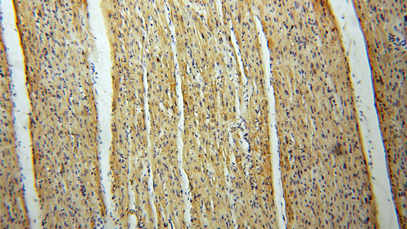 Immunohistochemical of paraffin-embedded human heart using Catalog No:112580(MECR antibody) at dilution of 1:100 (under 10x lens)