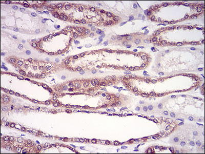Immunohistochemical analysis of paraffin-embedded kidney tissues using HPRT1 mouse mAb with DAB staining.