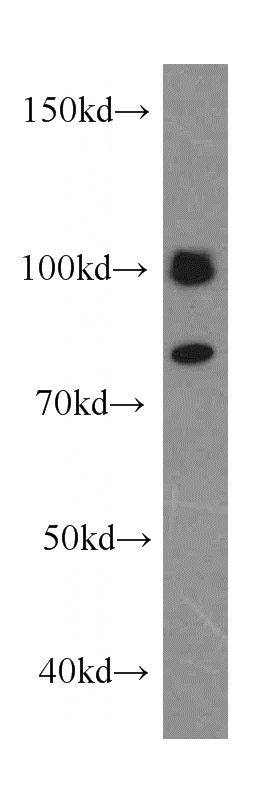 HT-1080 cells were subjected to SDS PAGE followed by western blot with Catalog No:108817(CALCocO1 antibody) at dilution of 1:400