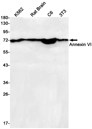 Western blot detection of Annexin VI in K562,Rat Brain,C6,3T3 cell lysates using Annexin VI Rabbit pAb(1:1000 diluted).Predicted band size:76kDa.Observed band size:70kDa.