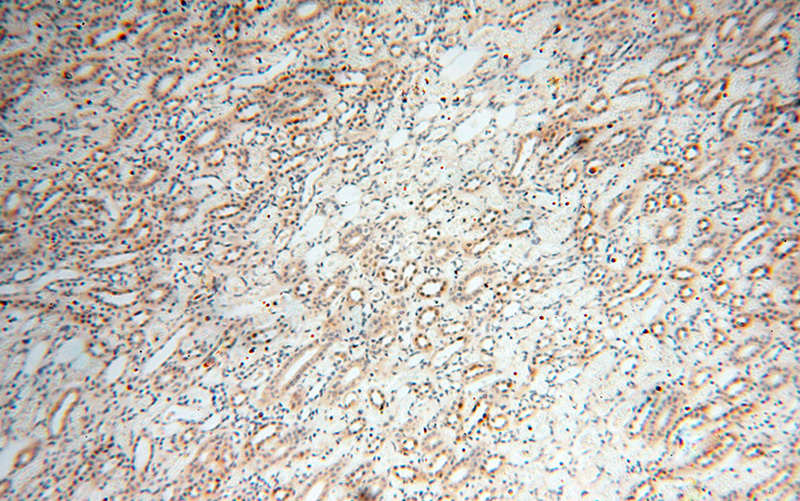 Immunohistochemical of paraffin-embedded human kidney using Catalog No:108071(ANKRD2 antibody) at dilution of 1:100 (under 10x lens)