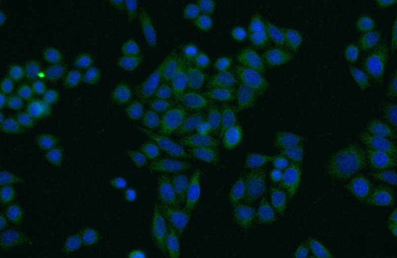 Immunofluorescent analysis of HeLa cells using Catalog No:116163(TOB1 Antibody) at dilution of 1:25 and Alexa Fluor 488-congugated AffiniPure Goat Anti-Rabbit IgG(H+L)