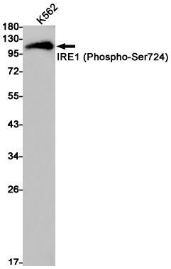 Western blot detection of IRE1 (Phospho-Ser724) in K562 cell lysates using IRE1 (Phospho-Ser724) Rabbit pAb(1:1000 diluted).Predicted band size:110kDa.Observed band size:110kDa.
