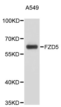 Western blot - FZD5 Polyclonal Antibody 