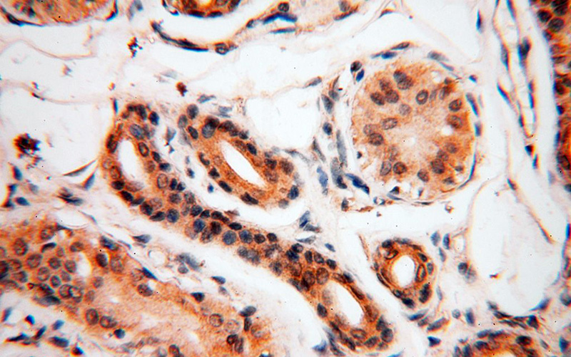 Immunohistochemical of paraffin-embedded human skin using Catalog No:114102(PPP2R3A antibody) at dilution of 1:100 (under 40x lens)