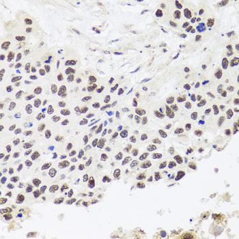 Immunohistochemistry - RPP30 Polyclonal Antibody 