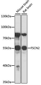 Western blot - FSCN2 Polyclonal Antibody 