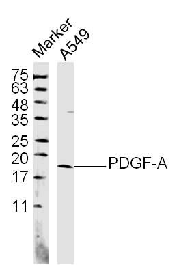 Fig1: Sample: A549 (human)Cell Lysate at 40 ug; Primary: Anti- PDGF-A at 1/300 dilution; Secondary: IRDye800CW Goat Anti-Rabbit IgG at 1/20000 dilution; Predicted band size: 14 kD; Observed band size: 18 kD