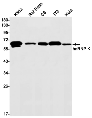 Western blot detection of hnRNP K in K562,Rat Brain,C6,3T3,Hela cell lysates using hnRNP K Rabbit mAb(1:1000 diluted).Predicted band size:51kDa.Observed band size:62kDa.
