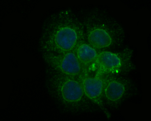 Fig3: ICC staining PHF8 in JAR cells (green). The nuclear counter stain is DAPI (blue). Cells were fixed in paraformaldehyde, permeabilised with 0.25% Triton X100/PBS.