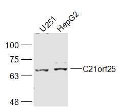 Fig1: Sample:; U251(Human) Cell Lysate at 40 ug; HepG2(Human) Cell Lysate at 40 ug; Primary: Anti-C21orf25 at 1/300 dilution; Secondary: IRDye800CW Goat Anti-Rabbit IgG at 1/20000 dilution; Predicted band size: 71 kD; Observed band size: 71 kD