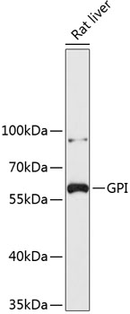 Western blot - GPI Polyclonal Antibody 