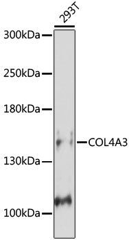 Western blot - COL4A3 Polyclonal Antibody 