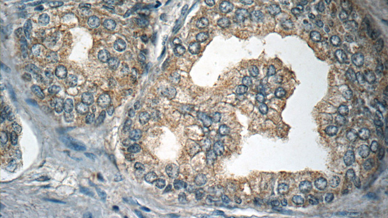 Immunohistochemistry of paraffin-embedded human prostate hyperplasia slide using Catalog No:111712(HTR4 Antibody) at dilution of 1:50