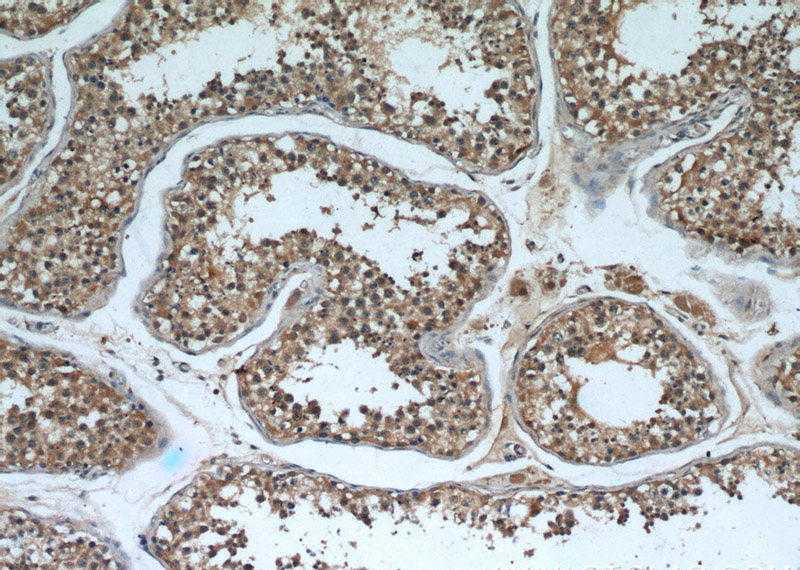 Immunohistochemical of paraffin-embedded human testis using Catalog No:107634(TPP2 antibody) at dilution of 1:50 (under 10x lens)