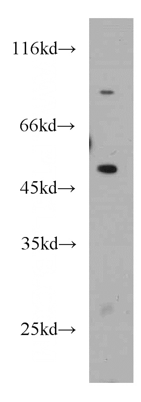 RAW264.7 cells were subjected to SDS PAGE followed by western blot with Catalog No:115331(SLC25A25 antibody) at dilution of 1:500