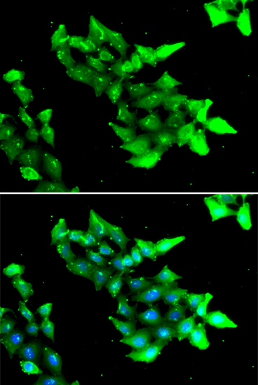 Immunofluorescence - KRIT1 Polyclonal Antibody 