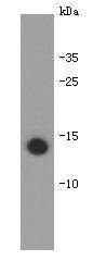 Fig1: Western blot analysis on bioactive recombinant human IL-31 protein using anti-IL-31 Mouse mAb (Cat. # 176656#).