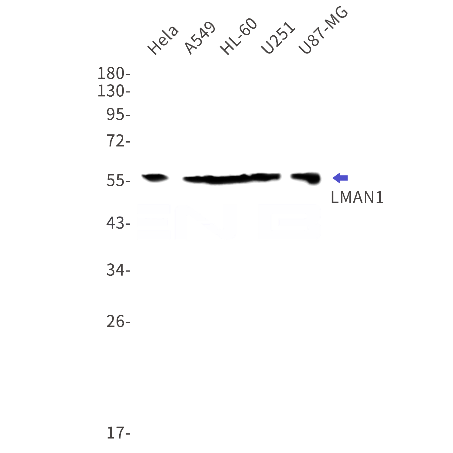 Western blot detection of LMAN1 in Hela,A549,HL-60,U251,U87-MG cell lysates using LMAN1 Rabbit mAb(1:1000 diluted).Predicted band size:58kDa.Observed band size:58kDa.