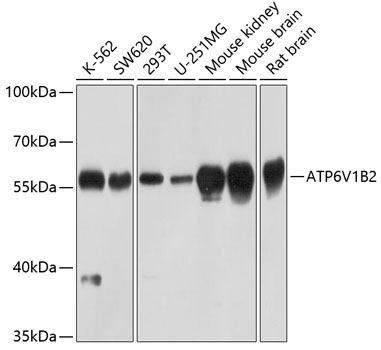 Western blot - ATP6V1B2 Polyclonal Antibody 