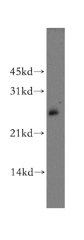 MCF7 cells were subjected to SDS PAGE followed by western blot with Catalog No:107925(AK3L1 antibody) at dilution of 1:400