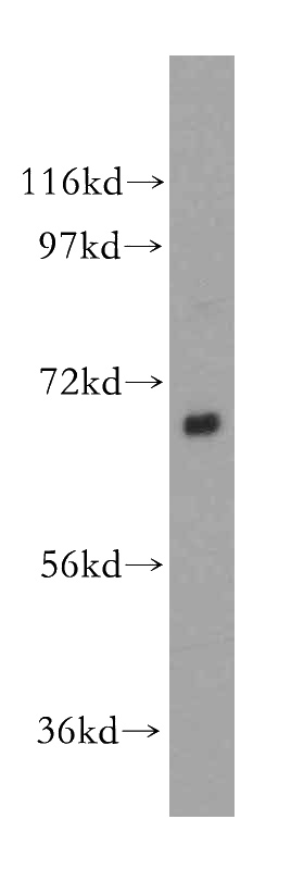 Raji cells were subjected to SDS PAGE followed by western blot with Catalog No:111353(HIP14; ZDHHC17 antibody) at dilution of 1:400