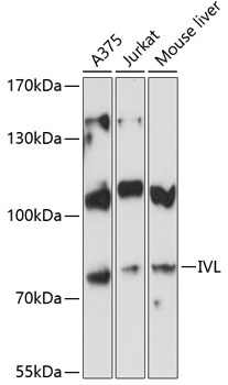 Western blot - IVL Polyclonal Antibody 