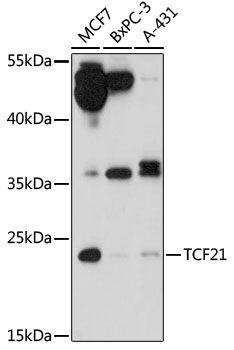 Western blot - TCF21 Polyclonal Antibody 