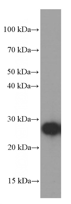 fetal human brain tissue were subjected to SDS PAGE followed by western blot with Catalog No:107288(GAMT Antibody) at dilution of 1:2000