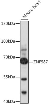 Western blot - ZNF587 Polyclonal Antibody 