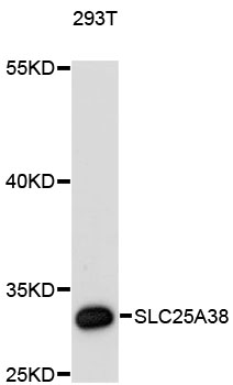Western blot - SLC25A38 Polyclonal Antibody 