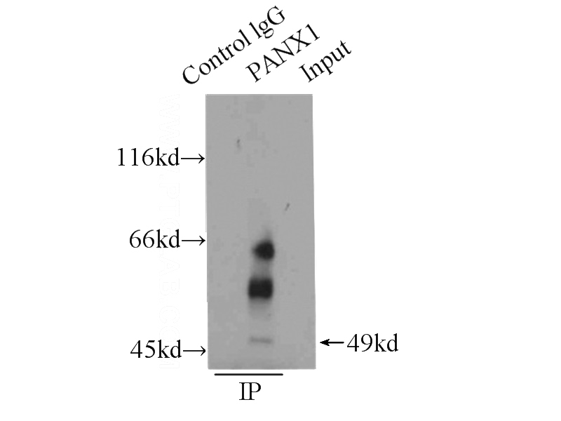 IP Result of anti-PANX1 (IP:Catalog No:113573, 3ug; Detection:Catalog No:113573 1:400) with HeLa cells lysate 2000ug.