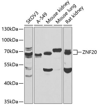 Western blot - ZNF20 Polyclonal Antibody 