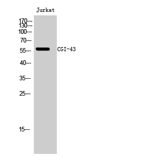 Fig1:; Western Blot analysis of Jurkat cells using CGI-43 Polyclonal Antibody diluted at 1: 500