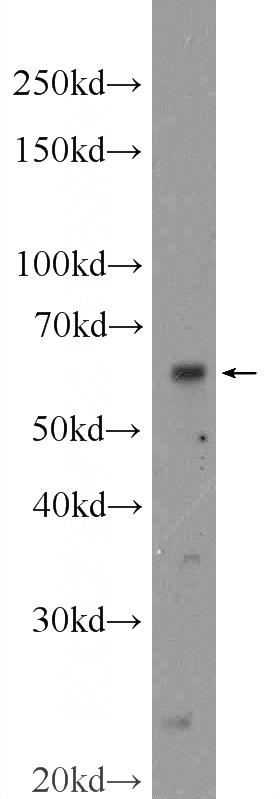 MDA-MB-453s cells were subjected to SDS PAGE followed by western blot with Catalog No:116198(TMEM87A Antibody) at dilution of 1:300