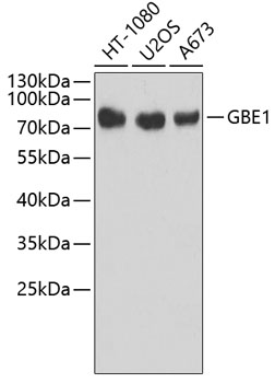 Western blot - GBE1 Polyclonal Antibody 