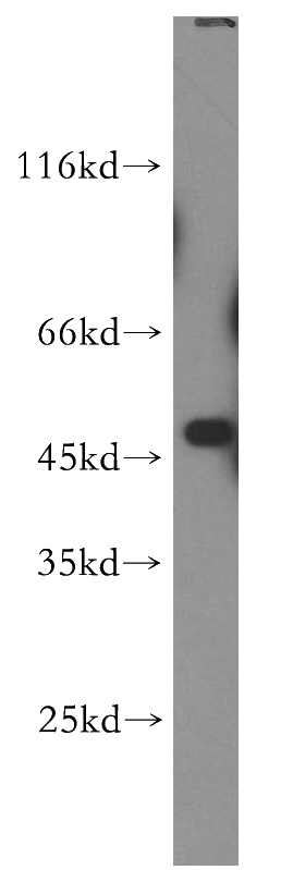 HEK-293 cells were subjected to SDS PAGE followed by western blot with Catalog No:107814(ABHD2 antibody) at dilution of 1:500