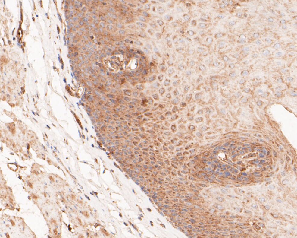 Fig6: Immunohistochemical analysis of paraffin-embedded human esophagus tissue using anti-Gasdermin D antibody. The section was pre-treated using heat mediated antigen retrieval with sodium citrate buffer (pH 6.0) for 20 minutes. The tissues were blocked in 5% BSA for 30 minutes at room temperature, washed with ddH2O and PBS, and then probed with the primary antibody ( 1/200) for 30 minutes at room temperature. The detection was performed using an HRP conjugated compact polymer system. DAB was used as the chromogen. Tissues were counterstained with hematoxylin and mounted with DPX.